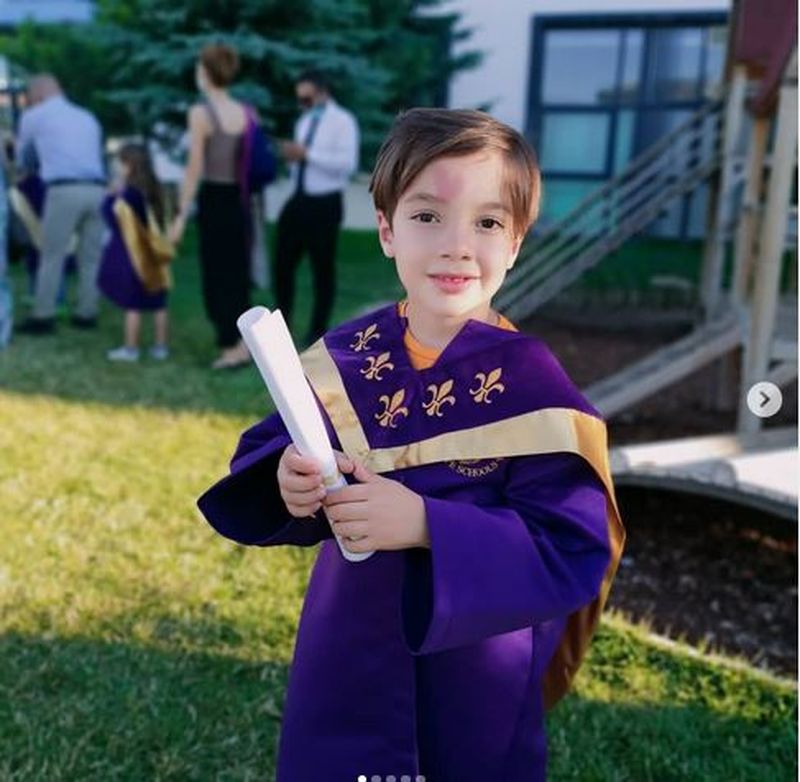 băiatul care s-a născut cu o inimioară în frunte