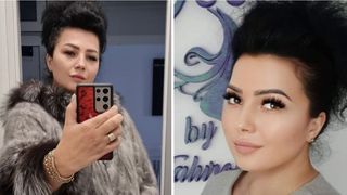 VIDEO | Intervenții estetice la falsa doctoriță