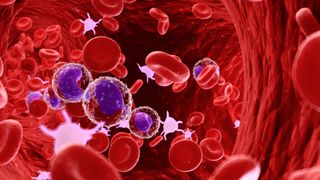  "Celulele CAR-T pot vindeca pacienții cu leucemie". Cazul a doi pacienți la care cancerul a intrat &icirc;n remisie