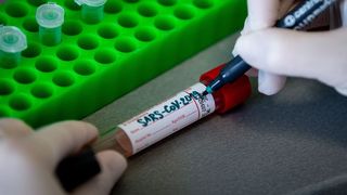 Bilanț COVID-19, 24 februarie. Peste 10.000 de noi cazuri de infectări