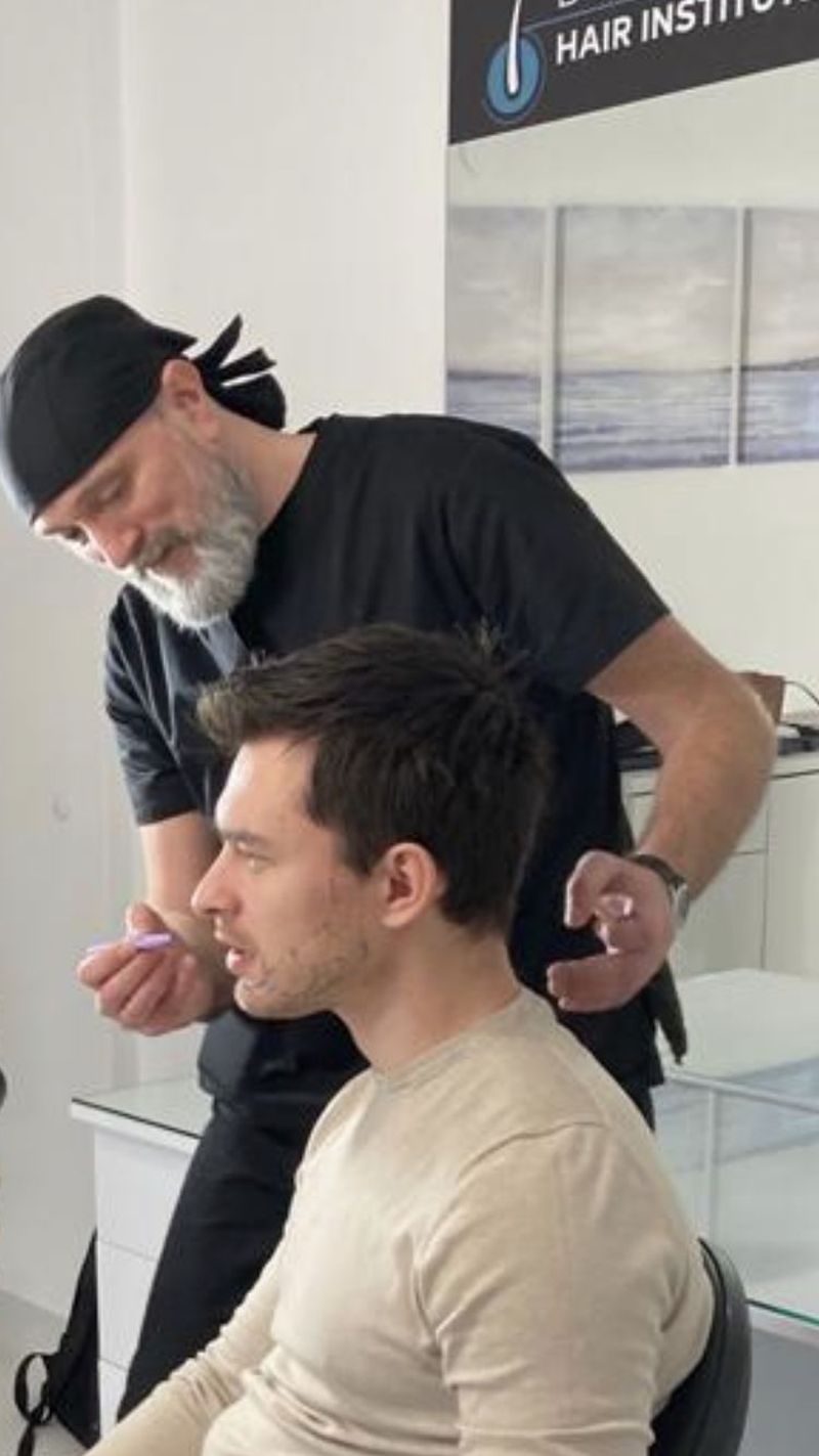 Implantul de barbă. Beneficii și recomandări