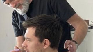 Implantul de barbă. Beneficii și recomandări