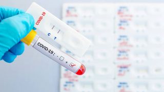 Bilanţ COVID-19 în România, 2 aprilie 2022. Aproximativ 2.000 de cazuri noi și 24 de decese au fost înregistrate în ultimele 24 de ore 