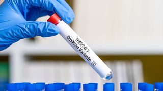 582 de cazuri noi de COVID-19, în ultimele 24 de ore. Au fost raportate 6 decese