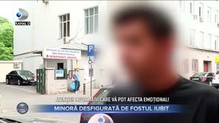 Minoră desfigurată de fostul iubit