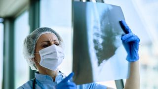 Explozie a cazurilor de pneumonie la Spitalul de Boli Infecţioase Timişoara