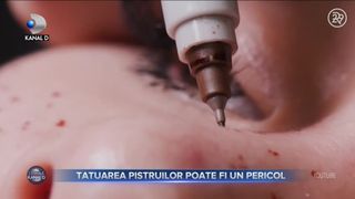 Tatuarea pistruilor poate fi un pericol