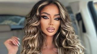 Bianca Drăgușanu a apărut cu sânge pe față. Ce i s-a întâmplat vedetei