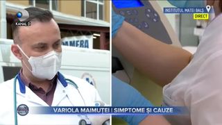 Variola maimuței - simptome și cauze