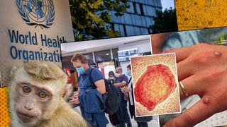 Categoria de persoane expuse riscului de infectare cu variola maimuței