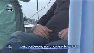 Variola maimuței pune România în gardă