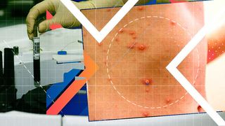 Teste PCR, pentru detectarea variolei maimuței