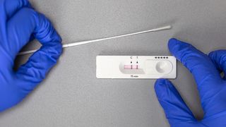 Bilanț coronavirus:  341 de cazuri noi de COVID-19, în ultimele 24 de ore