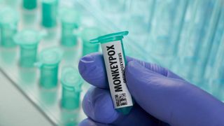  Spania începe vaccinarea contacților apropiați împotriva variolei maimuței