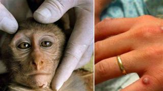  Bolnavii infectați cu variola maimuței trebuie să evite contactul cu animalele de companie