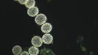  Cea mai mare bacterie din lume poate fi vizibilă cu ochiul liber