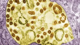  Două persoane au fost depistate pozitiv cu virusul Marburg, asemănător cu Ebola