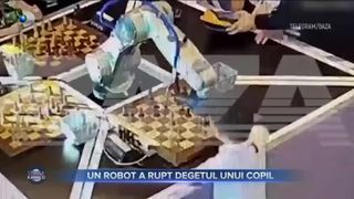 Un robot a rupt degetul unui copil