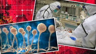 VIDEO - A fost raportat primul pacient cu ciupercă neagră din acest an. Ce este și care este starea de sănătate a pacientului