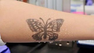 Tatuajul care monitorizează starea sănătăţii oamenilor. Cum funcționează