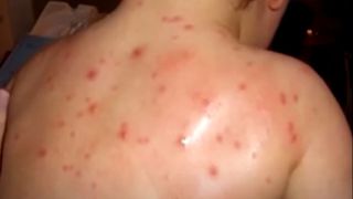 82 de copii au fost infectați cu noul virus al „gripei tomatelor”