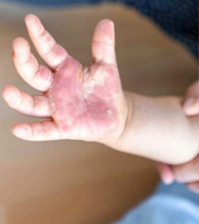 Gripa tomatelor. Care este primul simptom al noii boli