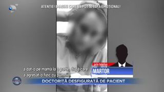 Doctoriță desfigurată de pacient