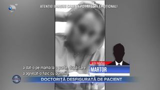 Doctoriță desfigurată de pacient