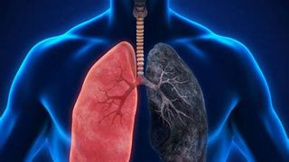 Argentina declară al treilea deces cauzat de o pneumonie necunoscută