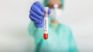 Variola maimuței a ajuns și în Ucraina. O anchetă epidemiologică este în desfășurare