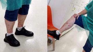 mușcată de ploșnițe