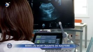 Bebeluș mort &icirc;nainte de naștere