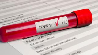 Bilanț Covid-19, 1 octombrie. Numărul infectărilor este în scădere