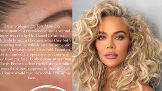 Una dintre surorile Kardashian, suspectă de cancer: „o operație imediată pentru a-mi îndepărta o tumoare de pe față”