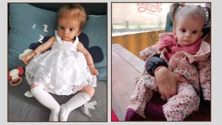 Evelin are nevoie de ajutorul nostru. Părinții micuței sunt disperați: „Inimioara ei are un defect care trebuie operat”