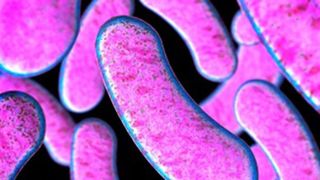 Un bărbat de 68 de ani a fost confirmat cu botulism