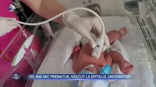 Cel mai mic prematur, născut la Spitalul Universitar