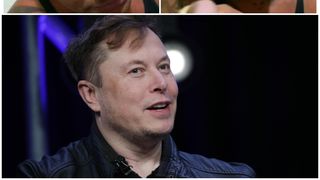 El ar putea fi cel mai mare fan al lui Elon Musk! Un influencer brazilian și-a tatuat numele miliardarului pe frunte. &bdquo;Te iubesc, Elon Musk&rdquo;