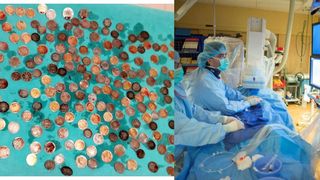 Incredibil ce au găsit medicii în stomacul unui bărbat: „A înghițit...”