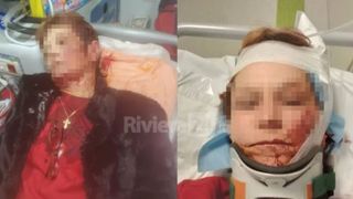 Doi români au fost snopiți în bătaie de concubinul fiicei lor. Au ajuns în stare gravă la spital
