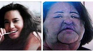 Povestea șocantă a lui Like Hang Mioku, femeia care a ajuns mutilată, după ce și-a injectat ulei pentru gătit în față. Motivul este halucinant