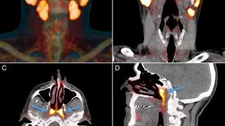 Cercetătorii au descoperit, accidental, un nou organ &icirc;n corpul uman. Unde este situat și ce funcții are