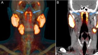 Cercetătorii au descoperit, accidental, un nou organ în corpul uman. Unde este situat și ce funcții are