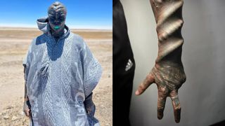 El este Anthony Loffredo, tânărul devenit „Extraterestrul Negru”. Bărbatul și-a tăiat degetele, nasul și a suferit și o intervenție chirurgicală la nivelul organelor genitale pentru a-și atinge obiectivul bizar