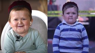 Povestea lui Hasbulla Magomedov, băiatul de 20 de ani, care arată ca un copil de 5 ani. Ce îl face să arate așa