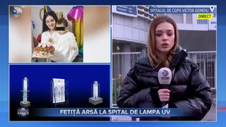 Fetiță arsă la spital de lampa UV