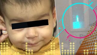 VIDEO - O fetiță de un an are corneea arsă după ce a fost expusă la o lampă UV la un spital din Capitală