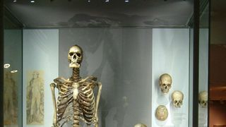 Povestea &bdquo;uriașul irlandez". Toată viața s-a temut să nu ajungă exponat după moarte și fix de asta a avut parte