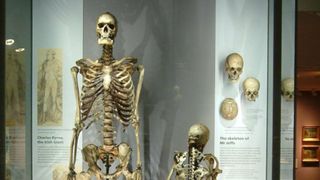 Povestea „uriașul irlandez". Toată viața s-a temut să nu ajungă exponat după moarte și fix de asta a avut parte