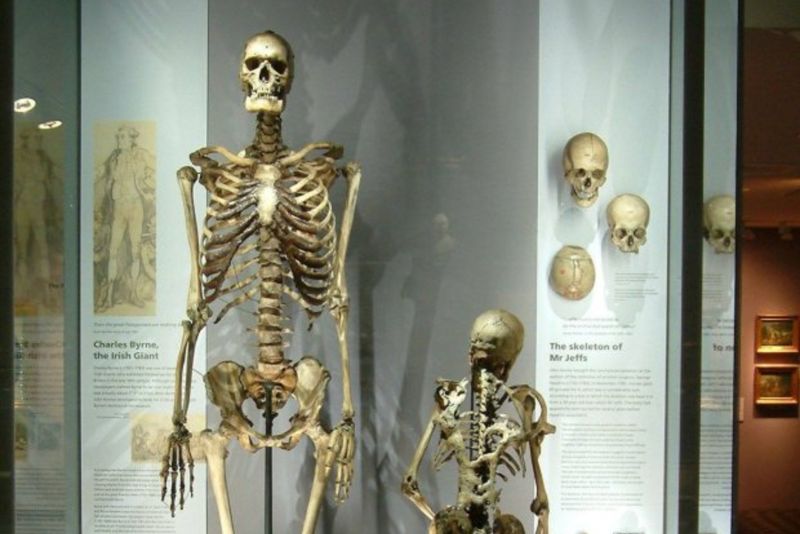 Povestea „uriașul irlandez". Toată viața s-a temut să nu ajungă exponat după moarte și fix de asta a avut parte